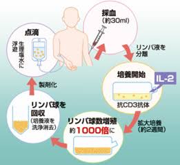 第4の癌治療〜活性化リンパ球療法〜