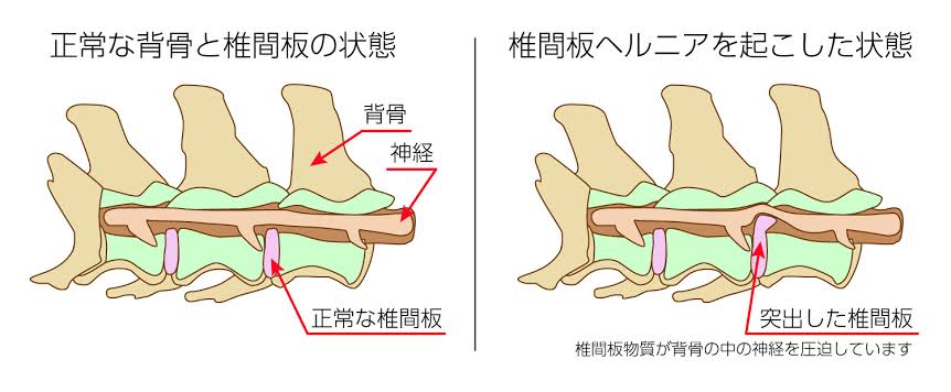 犬の椎間板ヘルニアにおける外科的処置