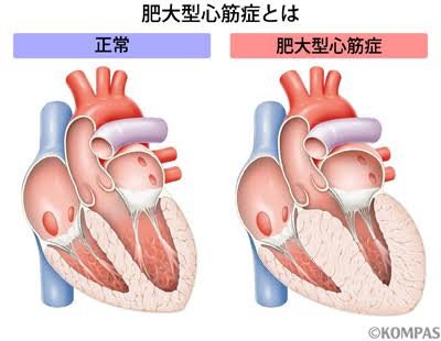 猫の肥大型心筋症の診断と治療